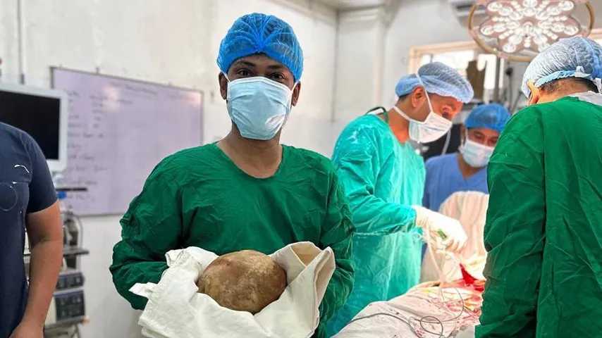 3,1 kg Nierenstein: Ärzte behaupten Rekord, „so groß wie ein Straußenei
